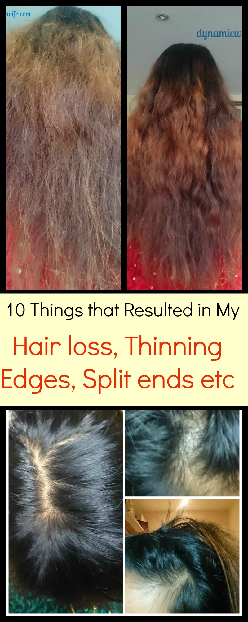 10 Causes of My Thinning Edges, Bald Spot and Split Ends! (Photos)