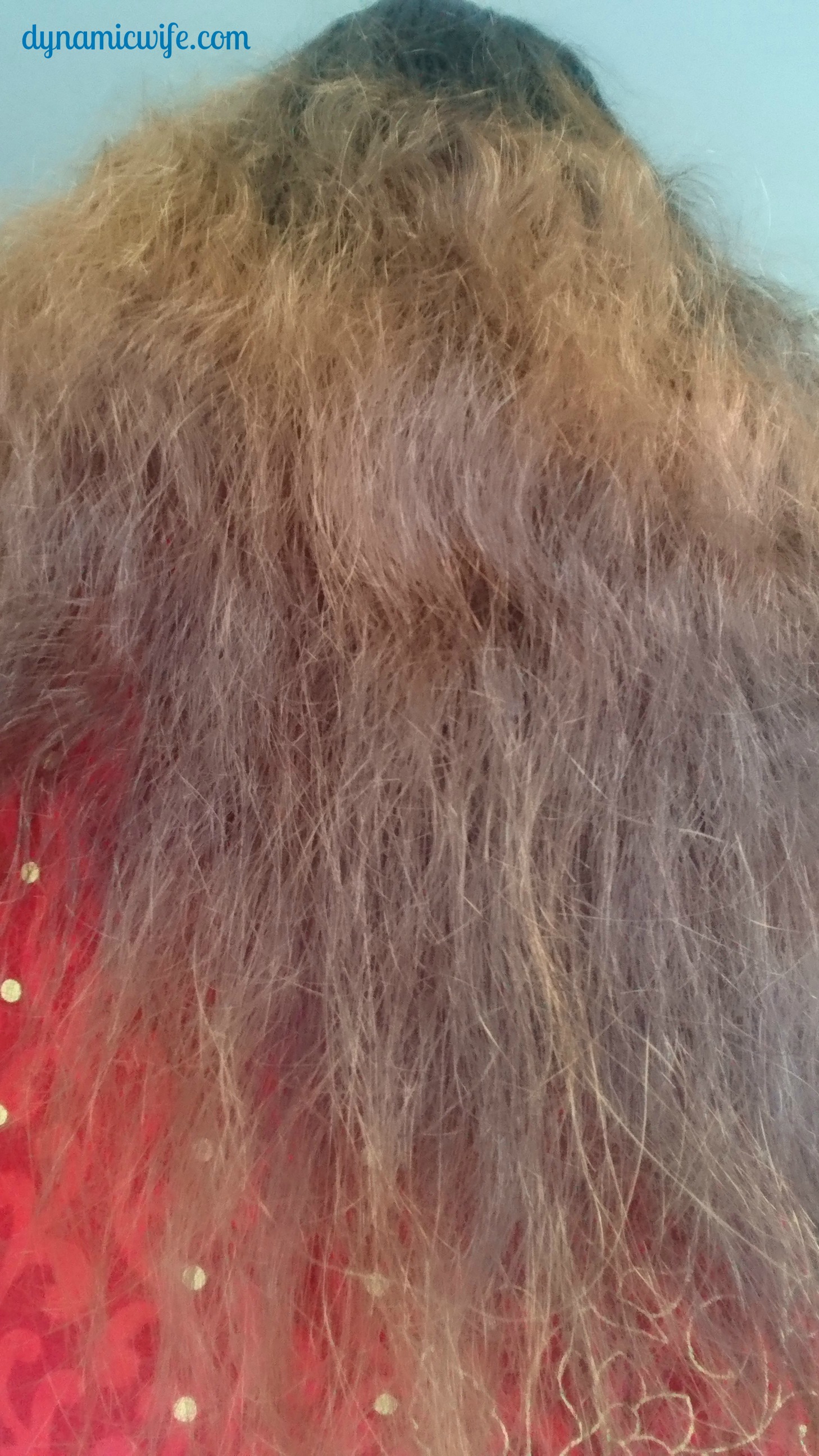 10 Causes of My Thinning Edges, Bald Spot and Split Ends! (Photos)