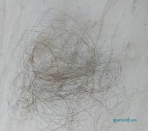 hairloss