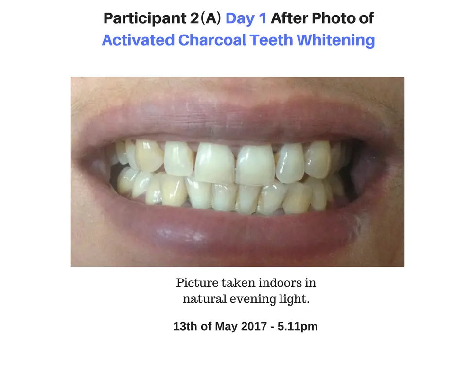 Participant 2 Day 1 Photo of Activated Charcoal Whitening Results