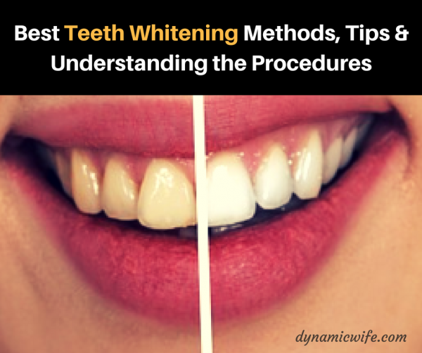 Best Teeth Whitening Methods, Tips & Procedures Explained!