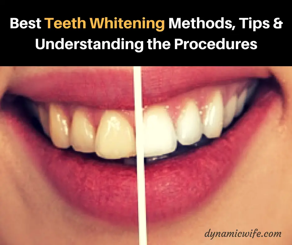 best teeth whitening