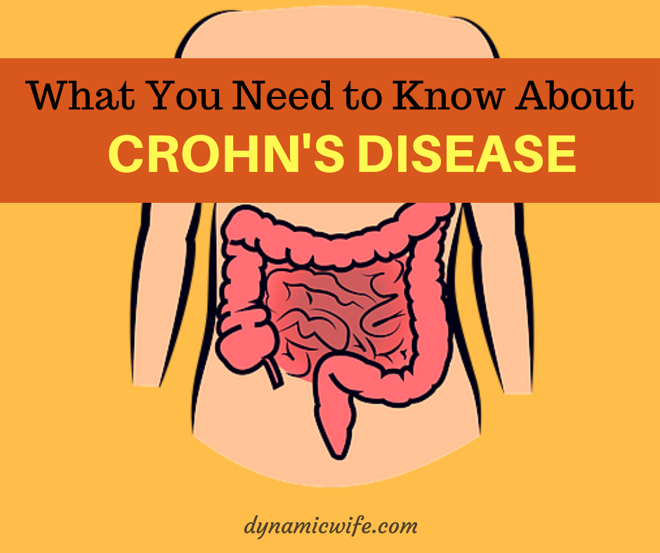 Crohn's Disease SYMPTOMS and Treatment Facts You Should Know