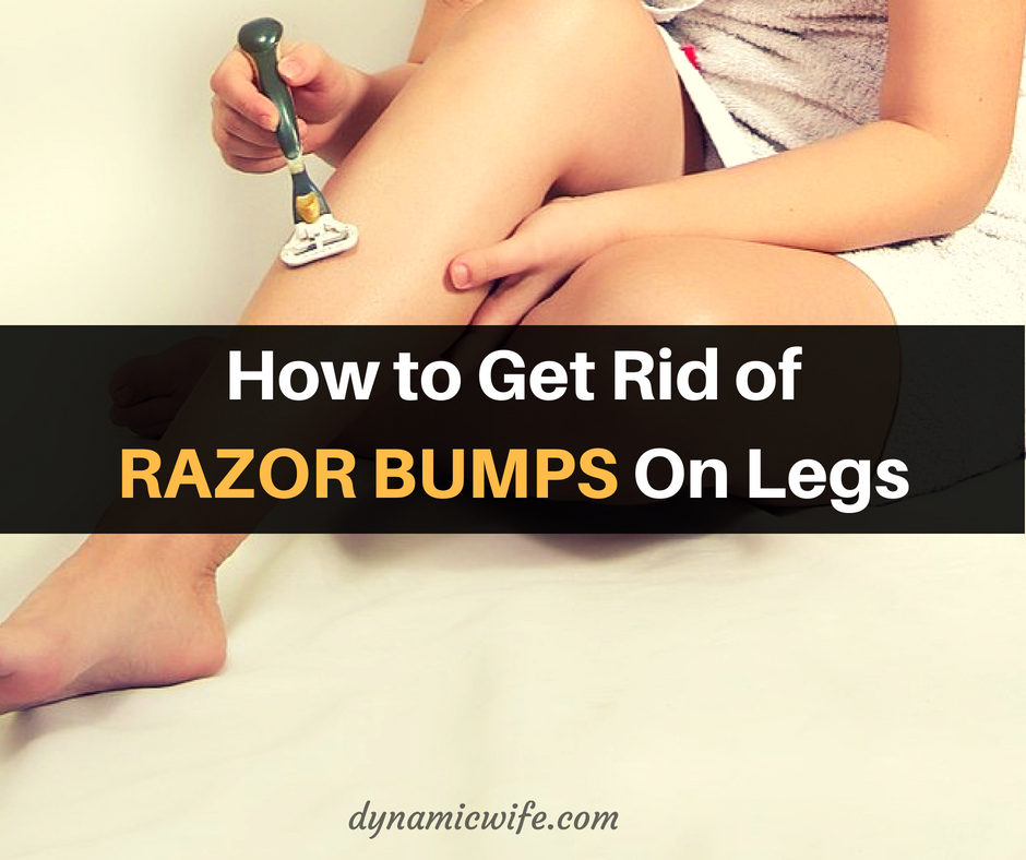 how to get rid of razor bumps on legs