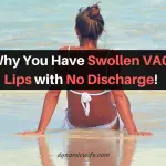 Why You Have Swollen Vaginal Lips With No Discharge