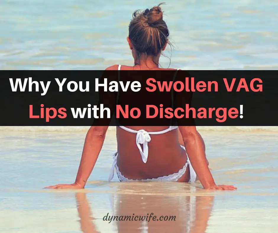 itchy swollen vag lips no discharge